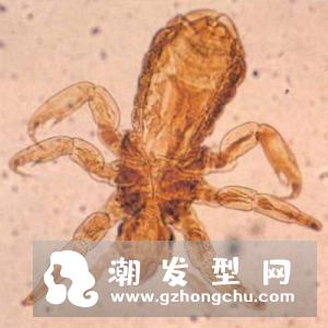 头虱的卵是白色的吗 怎么彻底去除