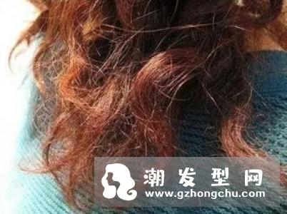防脱洗发水排行榜 吸烟会脱发吗