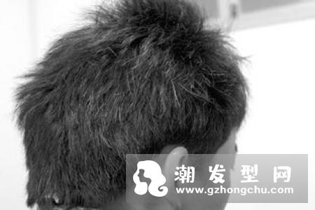 少年白头发是什么原因 头发变黑的方法有哪些