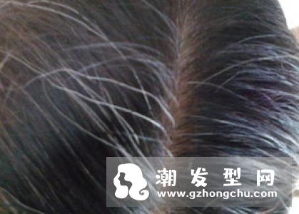 长期染发得白血病是真的吗 想染发的人要注意什么