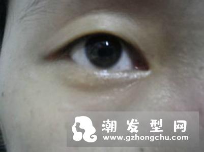 argentum银霜适合什么肤质 主要成分是什么