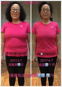养森瘦瘦包怎么用 价格及什么人不能用