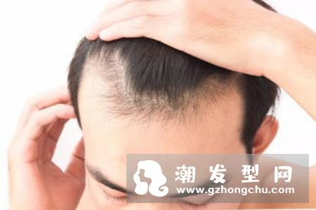 改变6个洗头习惯 重新救回干枯发丝
