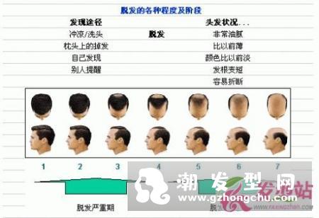 脱发用生姜擦有用吗 民间治疗脱发偏方值得一试