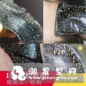 痘痘贴哪个牌子好 有副作用吗