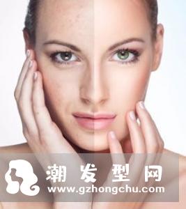 鼻膜去黑头多久撕掉 多久一次