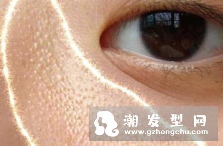 眼皮上长的小白疙瘩是什么 怎么去除
