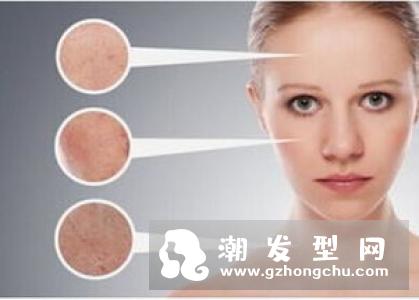 脸上长痘痘可以用酒精消毒吗 什么情况下可以用