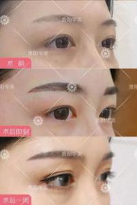 纹眉补色后还会结痂吗 半永久二次补色结痂掉痂时间