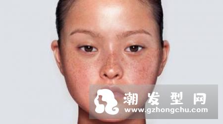 男生头发发黄什么原因 缺什么维生素