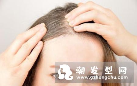 头发自然黄是什么原因 吃什么变黑