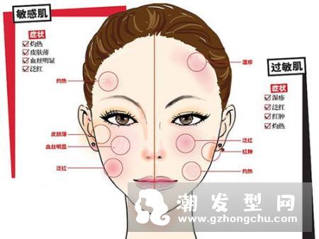 眼睛周围的皮肤发红发痒脱皮是什么原因 怎么护理