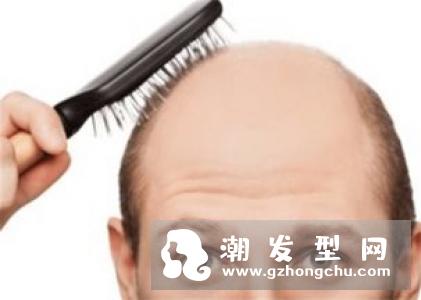 侧柏叶对脱发有效果吗 洗头的方法是怎样的