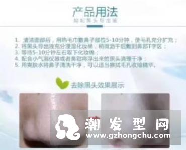 黑头导出液要敷多久 用完要洗吗