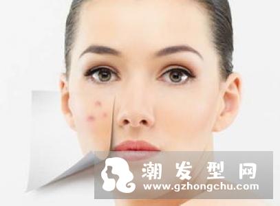 维生素e作用及功能 外用怎么去痘印