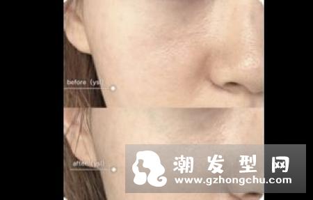 香奈儿果冻气垫和ysl哪个好 和圣罗兰气垫的区别