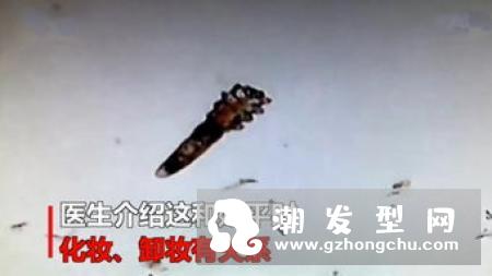 眼睛周围的皮肤发红发痒脱皮是什么原因 怎么护理