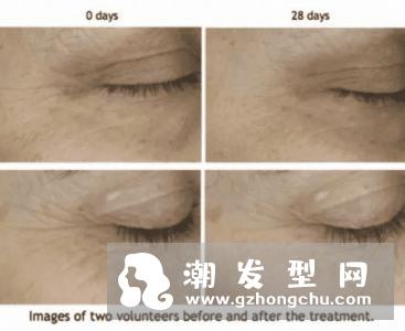 雅诗兰黛线雕精华的使用顺序 有线雕效果吗