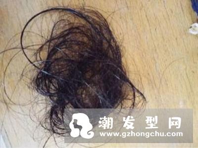 阴虱跑到头发上怎么办 在头发上能生活吗