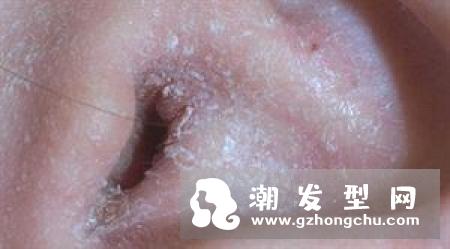 凡士林唇膏用手抹吗 可以天天用吗