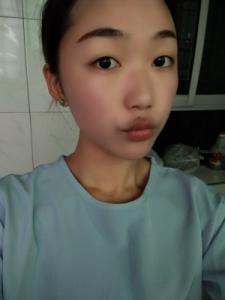染发剂过敏了怎么洗掉 吃什么药