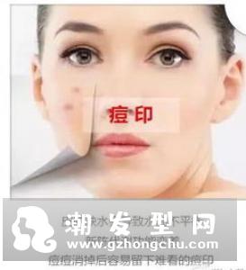 什么是假性过敏 面部缺水的症状有哪些