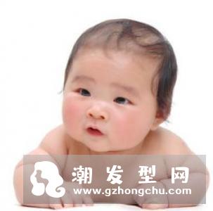头屑突然增多是什么原因 头上有大块头皮屑怎么办