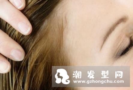 头屑突然增多是什么原因 头上有大块头皮屑怎么办