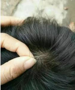 侧柏叶对脱发有效果吗 洗头的方法是怎样的