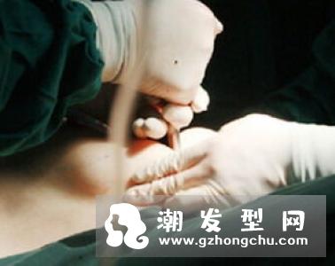 什么是自体脂肪丰胸 能大多少