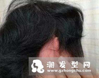 染发后头晕是过敏吗 头晕怎么办