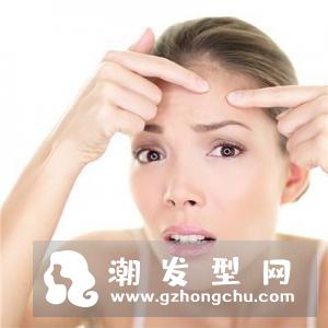 脸上三八纹是什么 怎么消除