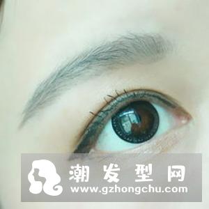 鼻翼两侧有红血丝是怎么回事 怎么去除
