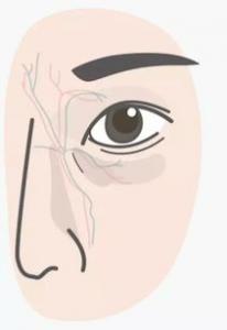敷眼膜过敏了是什么原因 怎么办