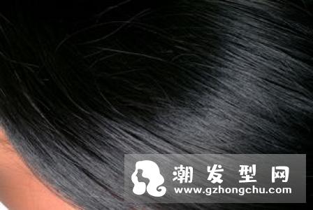 阴虱跑到头发上怎么办 在头发上能生活吗