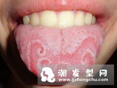 嘴唇上长泡可以涂芦荟胶吗 怎么涂
