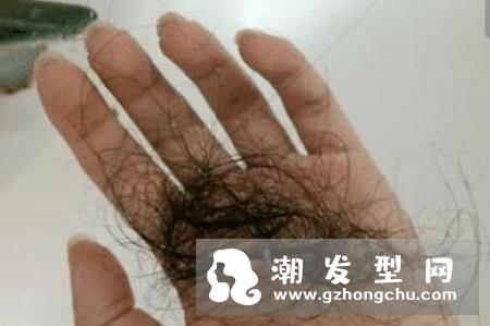 脱发吃什么好 用什么梳子好