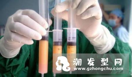 什么是自体脂肪丰胸 能大多少